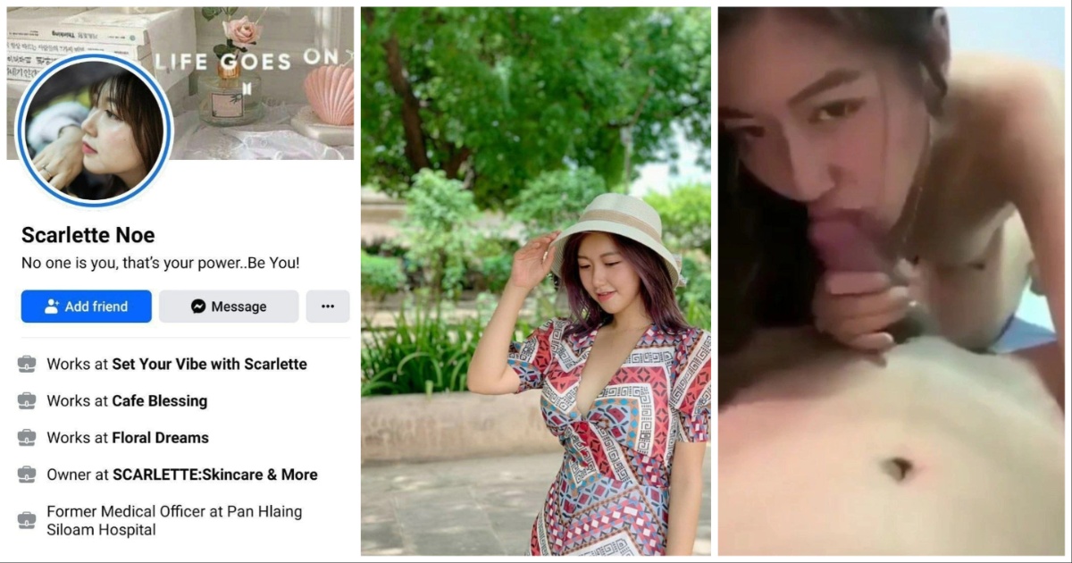 ဆရာဝန်မလေး Scarlette Noe တဲ့  ဘဲကိုကုန်းတဲ့ Sextape leakလေး